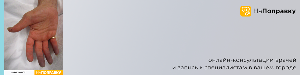 1) почему у тебя синие губы? - я ел