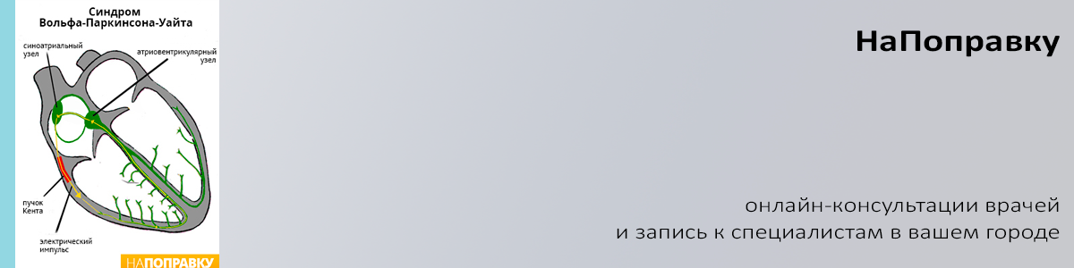 Причины и признаки тахикардии. Как лечить?