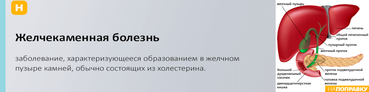 Диета при желчнокаменной болезни и холецистите