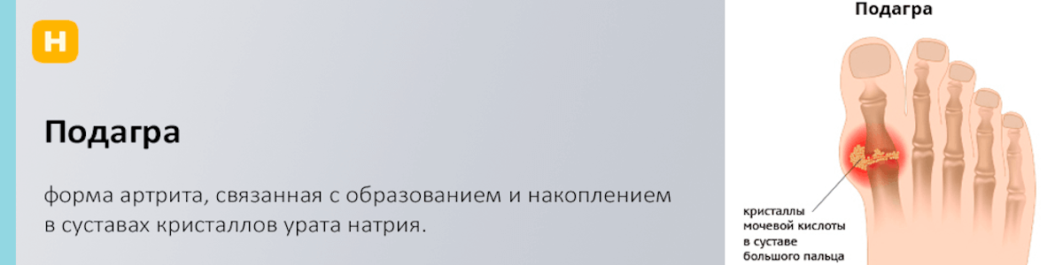 Подагра: симптомы и методы лечения. Диета и препараты при подагре.